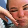 sunpoisoningluva
