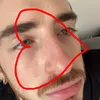 cyporb