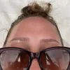 meggs_benedict
