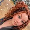 ambylea