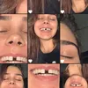 lilygeremia