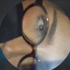 alapardin
