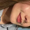 trixcerr