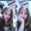 unzliana