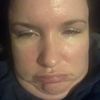pinkcheeks