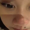 ntsycia