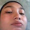 kye_esca