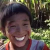 cautapchung
