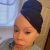kiss_my_vitiligo