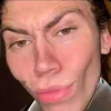 patrickingkoyla