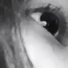 ankeototchosuckhoe