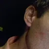 antoniotarca