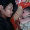 MI Hồng