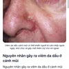 doilqther