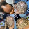 Houston Hairloss Braider