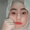zoppy_