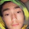 cheesy4skinsupereshay