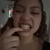 .skittllezz