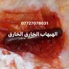 .07727078031