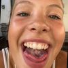 slurpexx