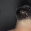 alzinooo
