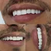 hollywoodsmile