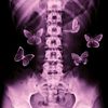 butterflies___345