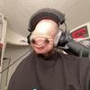 localbaldguy