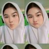 lstynt__