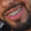 _daniel_dias_