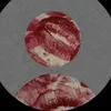 ch_rdt