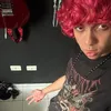 morgan_scar