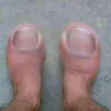 stinkytoe1888