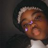 dimplefacemiracle