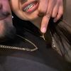 jonnnywildd