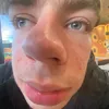 .chlorine0