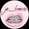 ja__braces