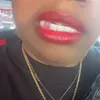 thedopediabetic614
