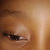 nomsamfene3