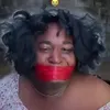 nicki_left_kidney