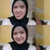 ikiss15