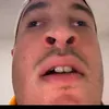 milzeboy
