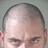 mustacchionero