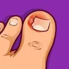 Unha Encravada_Ingrown Toenail