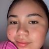 xallyrdguez