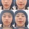 seemehh__