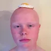 stinkytoehole