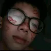 tinhbannutvo