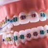 lexadental