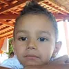 albernazzx